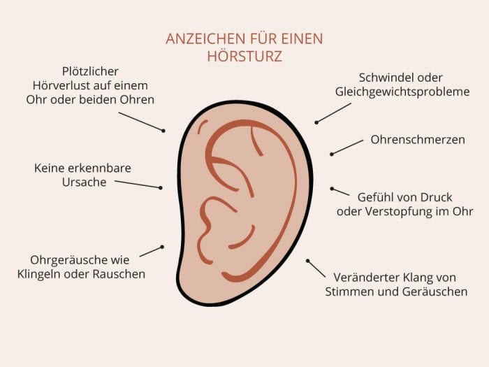 Wie Lange Nach Hörsturz Nicht Fliegen